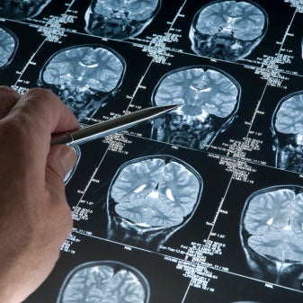A person reviewing images of the brain