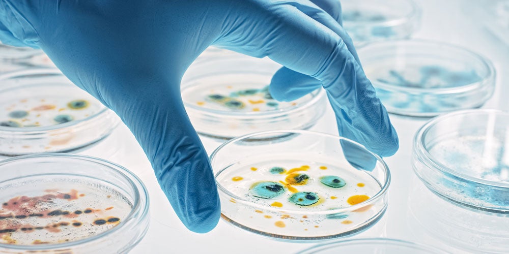 Gloved hand holding a petri dish with blue and yellow cells