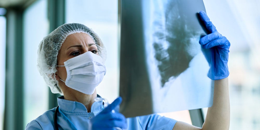 Female doctor examining patient's chest X-ray at the hospital