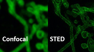 Mitochondrial membrane.   Conventional Confocal and STED (70nm resolution)