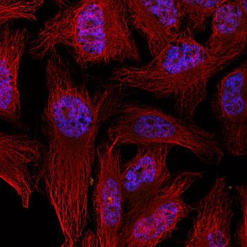 Example of data produced by the Multiphoton Microscope - Zeiss LSM