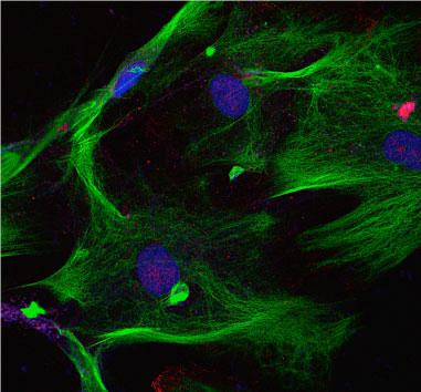 Data produced by the Olympus IX81 TIRF Microscope