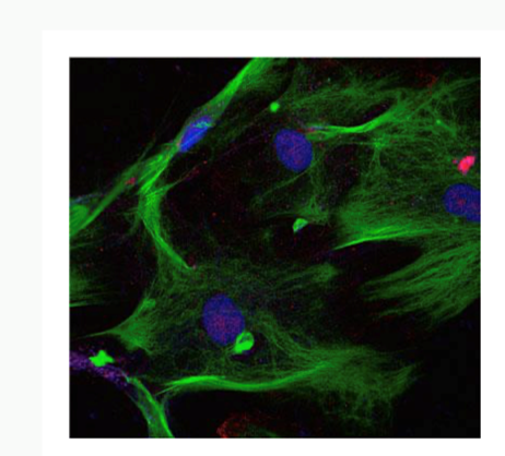 Imaging from Olympus IX81 inverted fluorescent microscope