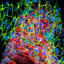 Microscale biomimetic tissue models