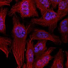 Example of data produced by the Multiphoton Microscope - Zeiss LSM